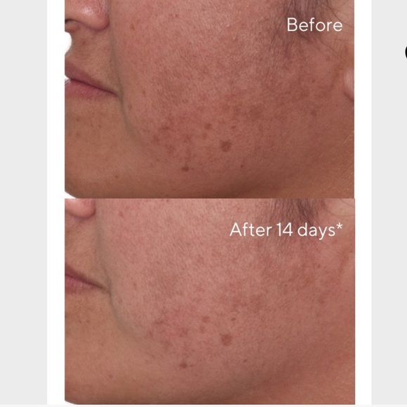 😊 NIB Murad Environmenral Sheild Rapid Dark Spot Correcting Serum 0.17 fl oz 😊 - Picture 3 of 7